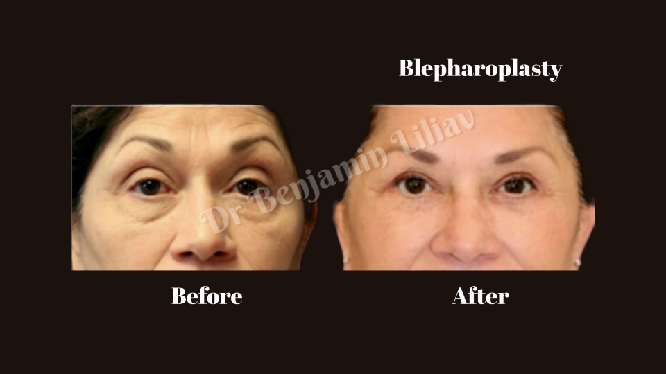 Case--2055 | Before and After Face